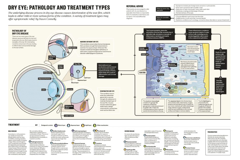 Infographic explaining the pathology and treatment types of dry eye disease