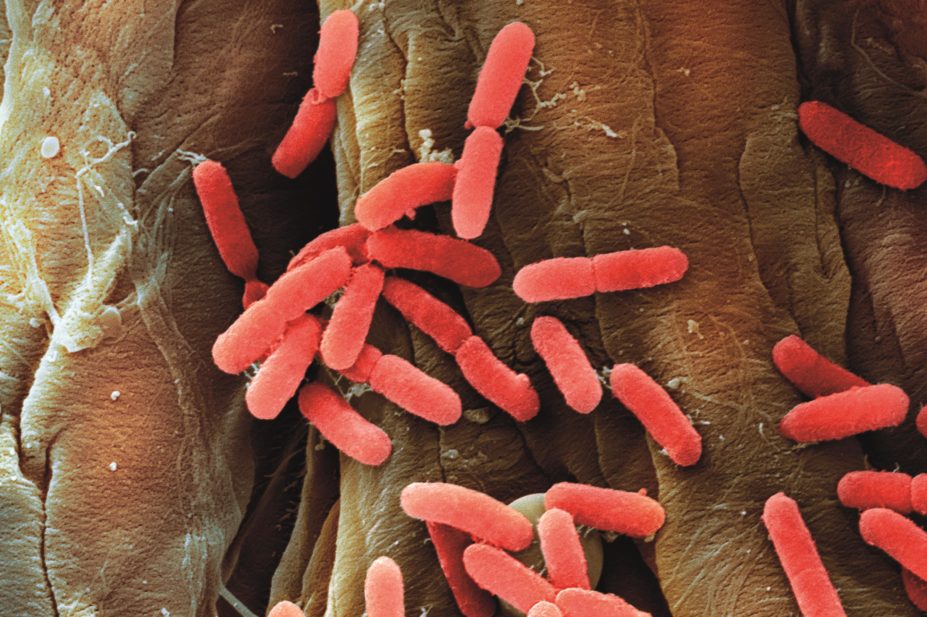 E-coli bacteria from a patient with a urinary tract infection