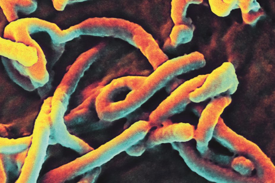 ebola-virus-budding-from-cell-micrograph-14