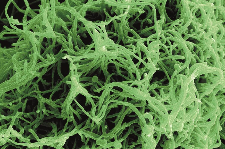 A new vaccine against the Zaire Ebola strain was tested in a phase III trial involving 7,651 people in Guinea. Results show that the efficacy of the vaccine was 100%. In the image, a micrograph of the ebola virus
