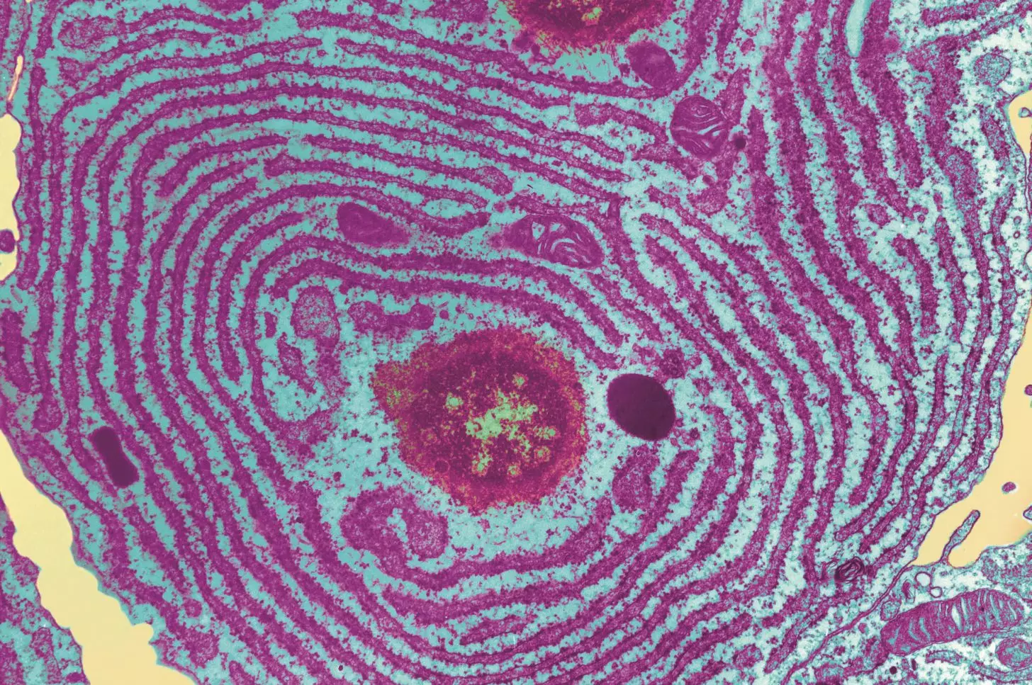 Assay screens compounds that target the endoplasmic reticulum - The ...