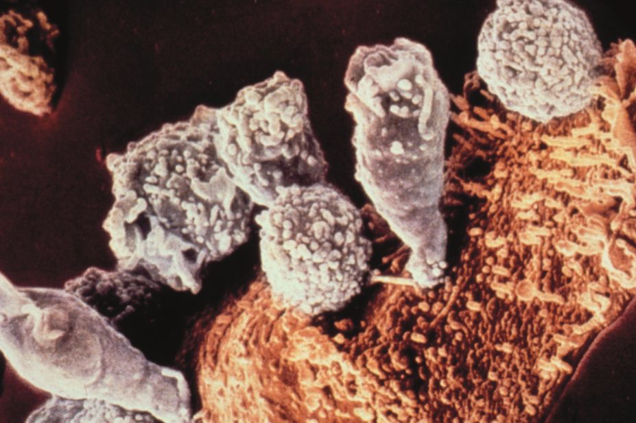 Micrograph of a group of tumor-specific T cells attacking a tumor cell
