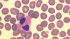 Eosinophil cell in the blood