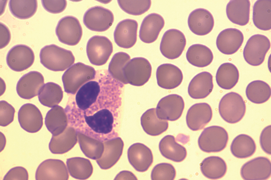 Eosinophil cell in the blood