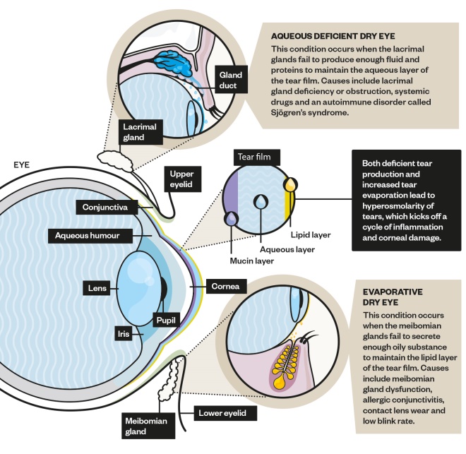 Pharmacy Technician s Guide Dry Eye Disease Pathophysiology And Risk Pharmacy Technician s Guide Dry Eye Disease Pathophysiology And Risk