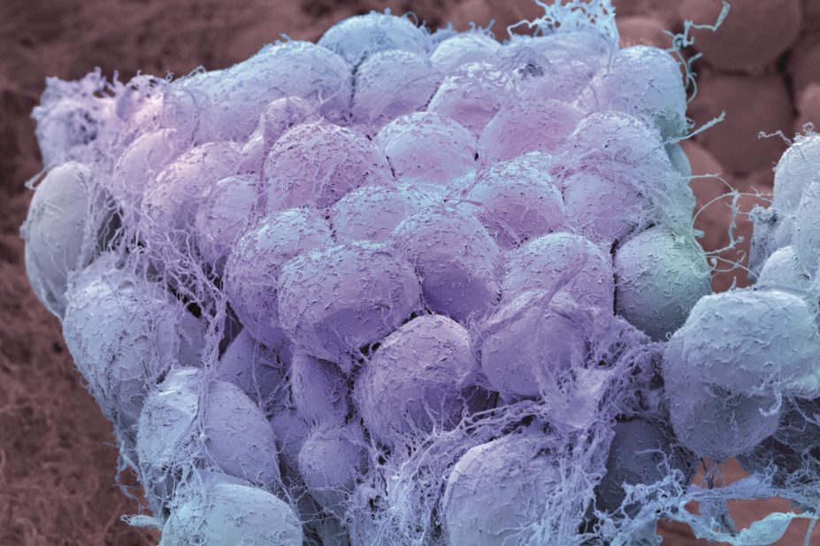 With more obesity drugs having been withdrawn in recent years than licensed, we look at the current pharmacological options that can be used in addition to lifestyle changes. In the image, scanning electron micrograph of fat tissue