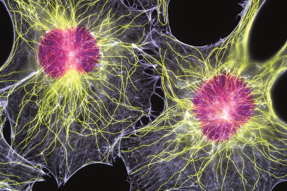 Researchers have discovered that an important component of the actin cytoskeleton, which plays a key role in cancer metastasis, has more than one isoform. In the image, fibroblast cells showing cytoskeleton