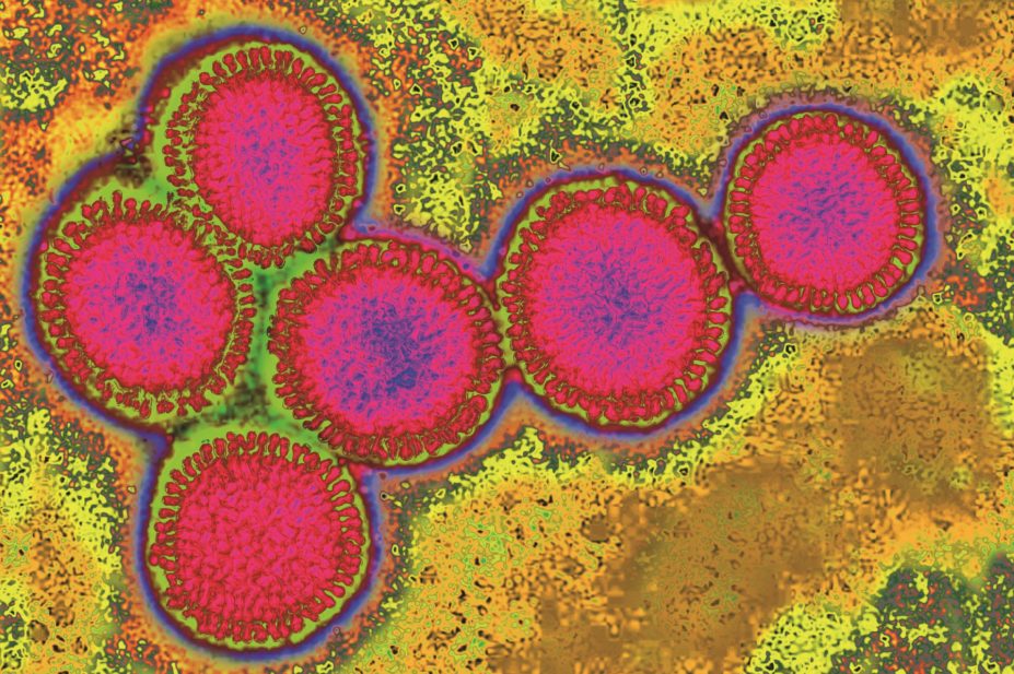 Over the course of a person’s lifetime they will be infected with multiple strains of influenza virus, leaving a specific pattern of antibodies in their blood. In the image, micrograph of the influenza virus