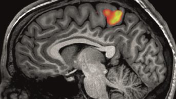fMRI brain scan image