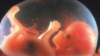Human foetus at 14 weeks