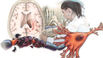 Illustration of research and multiple sclerosis showing scientists, brain with multiple sclerosis and a demyelinated sheath of a nerve fibre