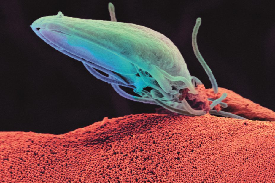 Giardia protozoan parasite (pictured) is the cause of the giardiasis infection, usually contracted by drinking contaminated water
