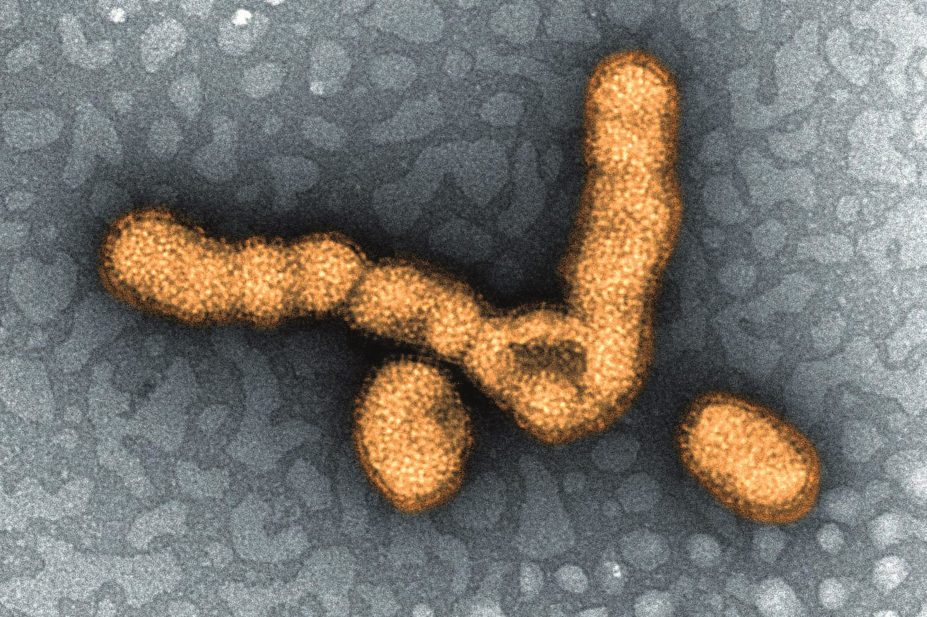 Micrograph of H1N1 virus