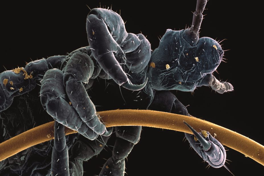 Coloured scanning electron micrograph (SEM) of the head and thorax of a human head louse (Pediculus humanus capitis) clinging to a strand of human hair.