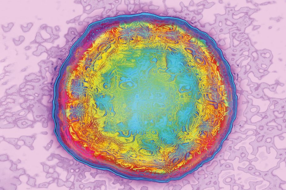 Transmission Electron Micrograph view (TEM) of Hepatitis B virus