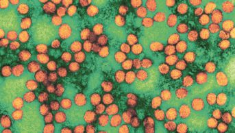 Electron micrograph of hepatitis C virus