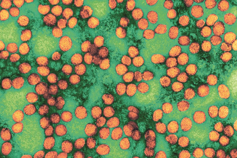 Electron micrograph of hepatitis C virus