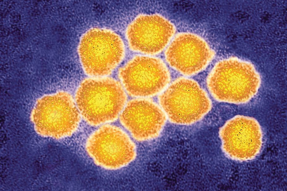 Hepatitis C virions micrograph