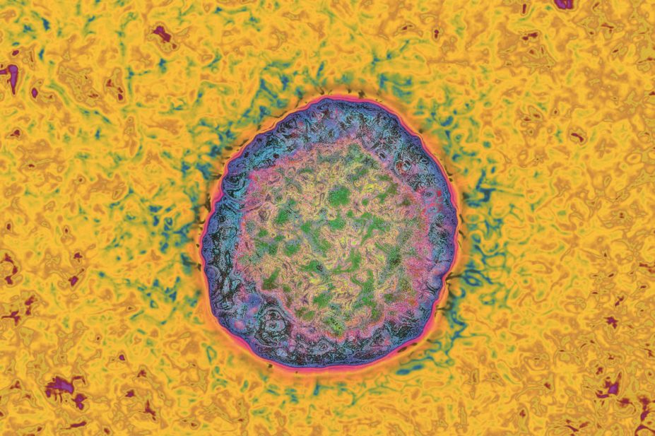 Micrograph of Hepatitis C virus