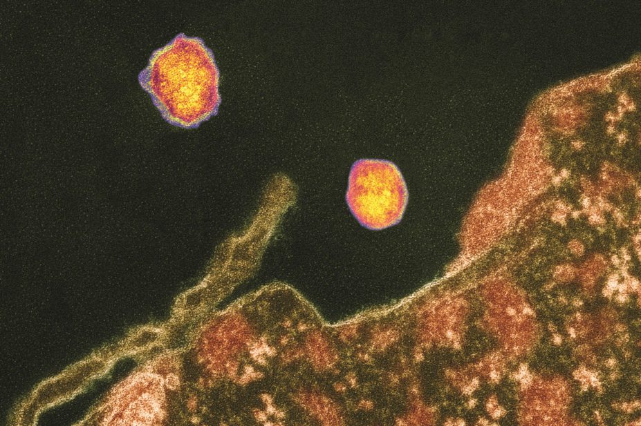 The US drugs regulator has issued a safety warning about two hepatitis C treatments, which it says can cause serious liver injury, which can result in death. In the image, micrograph of Hepatitis C viruses