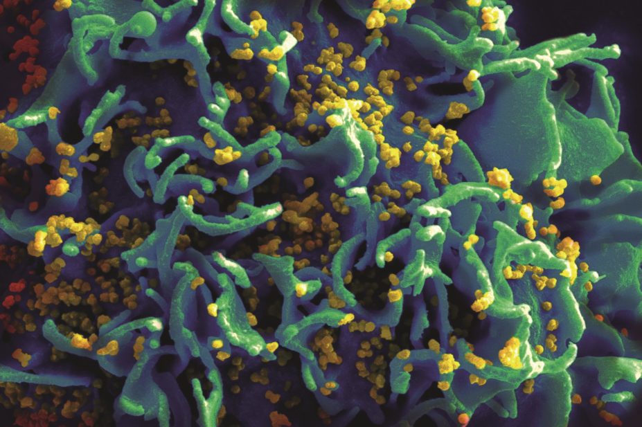 Use of antiretroviral therapy could contribute to a reduction in HIV virulence at the population level, study finds