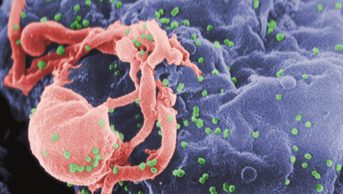 Researchers have elucidated the reasons why an HIV-1 vaccine, RV144, led to a mixed response in terms of HIV-1 infection risk. In the image, micrograph of HIV-1 budding (green) from cultured lymphocyte