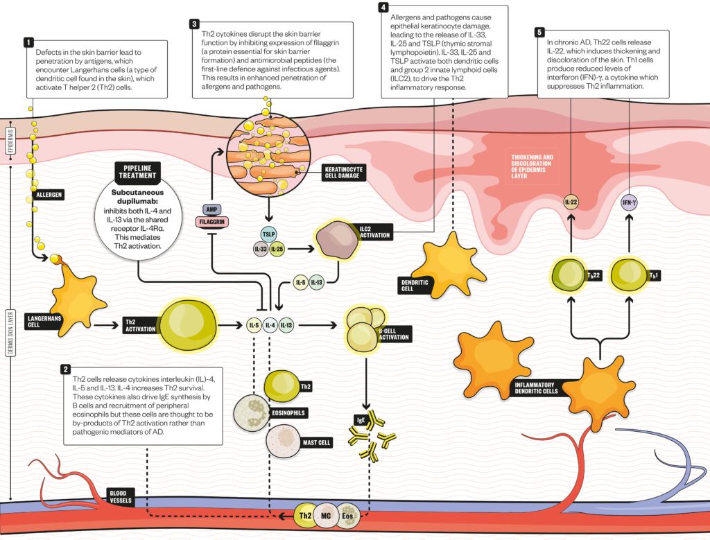 Atopic Dermatitis: Emerging And Current Treatments - The Pharmaceutical ...