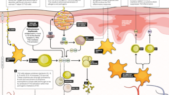 Infographic showing how dupilumab works