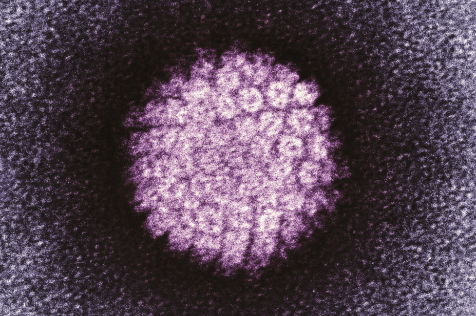 Coloured transmission electron micrograph (TEM) of human papillomavirus