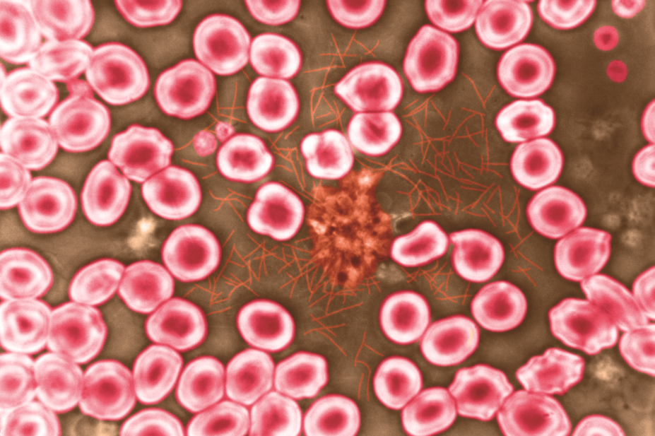 Human blood clotting light micrograph