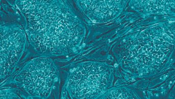 Human embryonic stem cells show evidence of medium to long-term safety and graft survival when transplanted into patients, study finds