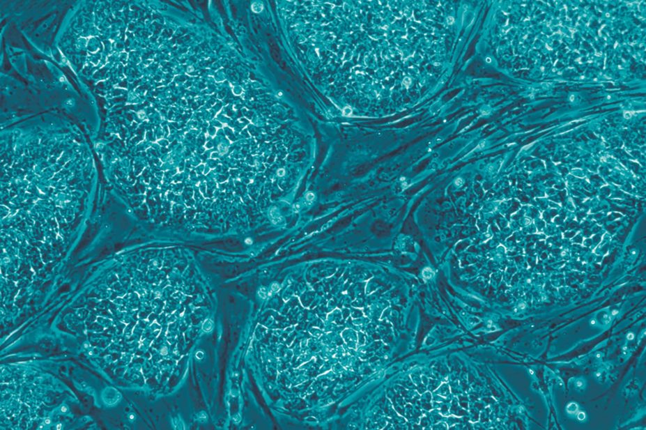 Human embryonic stem cells show evidence of medium to long-term safety and graft survival when transplanted into patients, study finds
