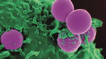Treatment with beta-lactam antibiotics could exacerbate methicillin-resistant Staphylococcus aureus (MRSA, pictured) skin infections, according to pre-clinical research published in Cell Host & Microbe
