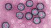 Transmission electron micrograph of the human papilloma virus (HPV)