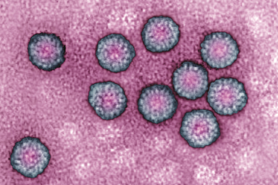 Transmission electron micrograph of the human papilloma virus (HPV)