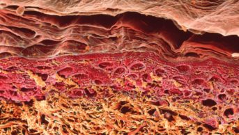 Micrograph of a cross section of human skin