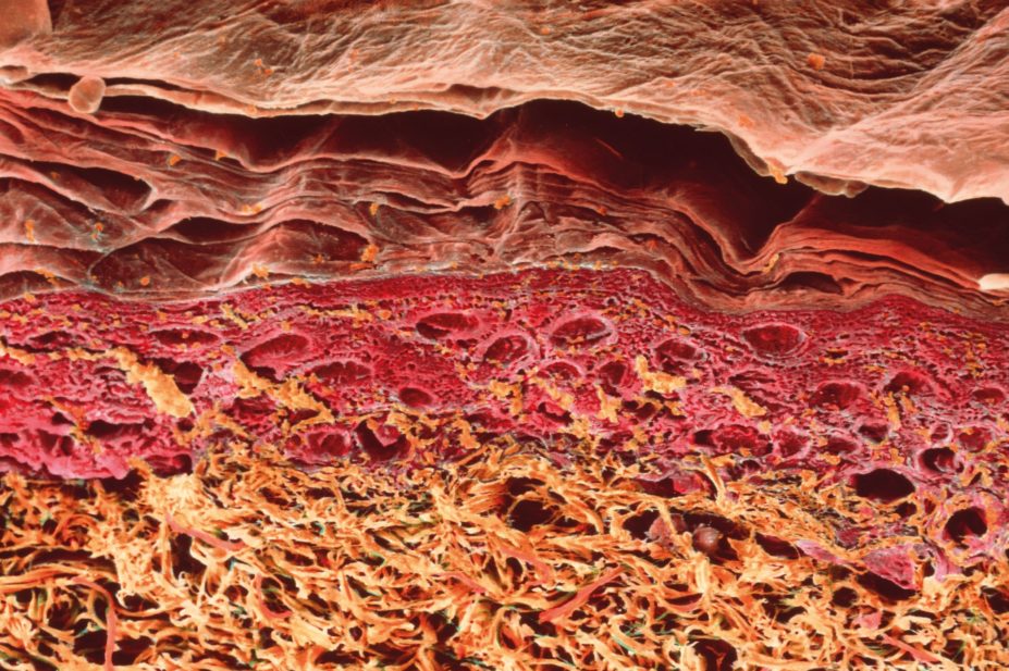 Micrograph of a cross section of human skin