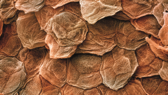Micrograph of human skin