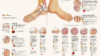 Infographic showing common foot conditions