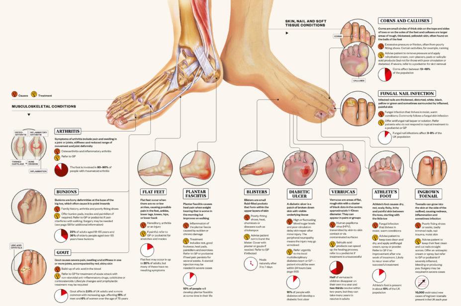 Infographic showing common foot conditions