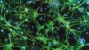 Immunofluorescent LM of astrocyte brain cells