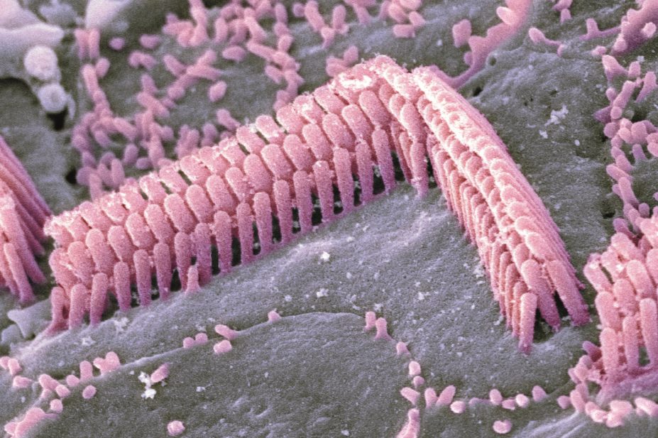 A study highlights that N-acetylcysteine could be beneficial in preventing ototoxicity with a class of antibiotics known to induce death of hair cells within the cochlea. In the image, micrograph of inner ear hair cells