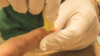 Person takes INR pin-prick blood test