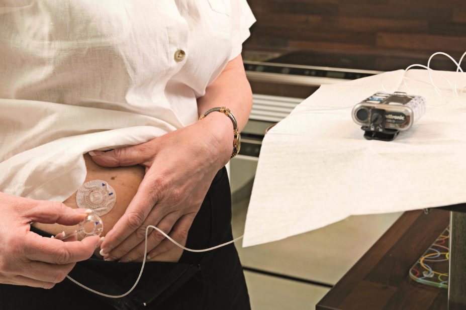 The European Association for the Study of Diabetes (EASD) and the American Diabetes Association (ADA) are calling for a radical review of how insulin pumps (pictured) are approved for use and monitored, citing serious safety gaps