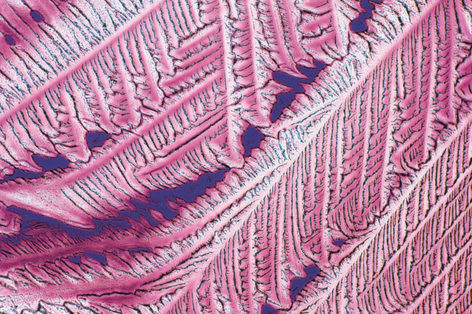 Iodine supplements during pregnancy could improve a child’s IQ and save UK money. In the image, micrograph of iodine crystals