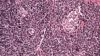 Micrograph of the islets of Langerhans found in the pancreas