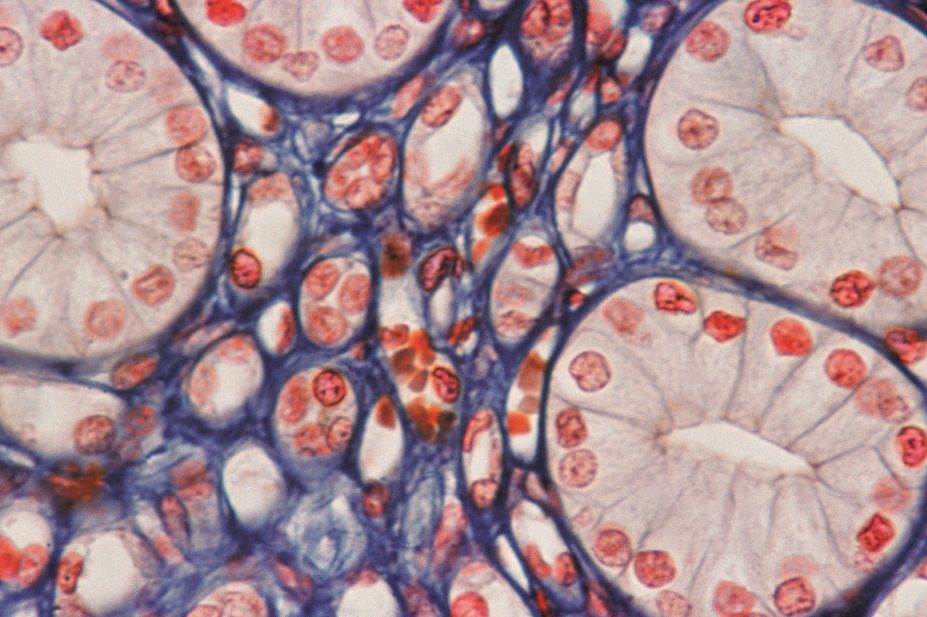 Light micrograph of kidney collecting ducts, which along with the distal convoluted tubule is the site of action for potassium-sparing diuretics
