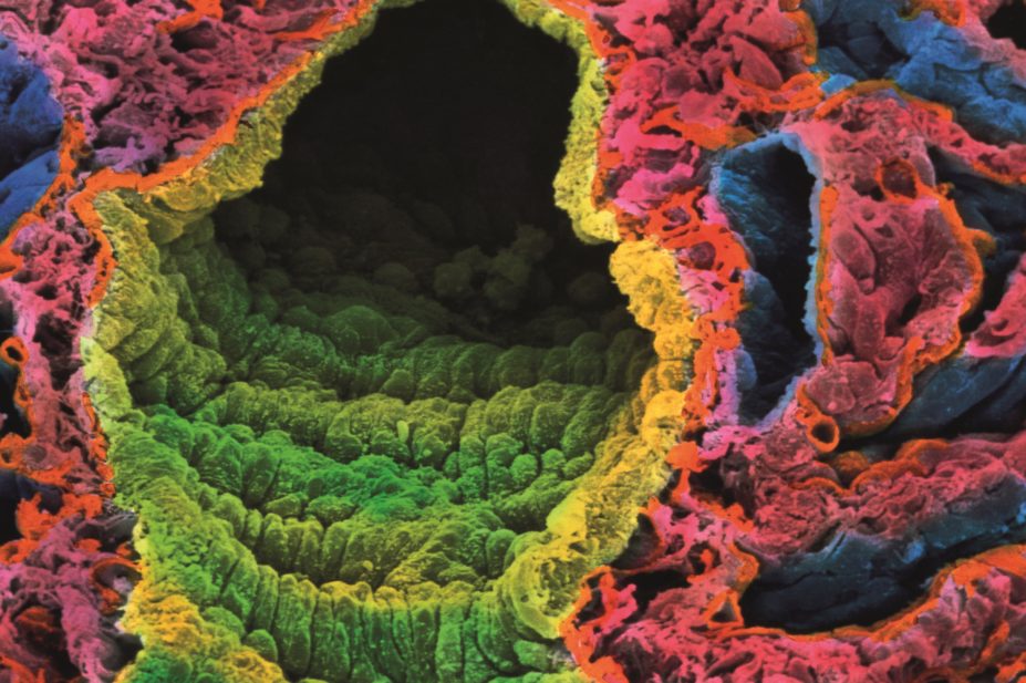 Inhaled corticosteroids (ICSs) are indicated in the management of most patients with asthma and some patients with chronic obstructive pulmonary disease (COPD). In the image, a scanning electron micrograph (SEM) showing alveoli and pulmonary blood vessels