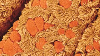 A new crop of biologic drugs promises to usher asthma treatment into the realm of personalised medicine. In the image, micrograph of lung lining