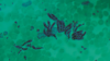 Micrograph of Plasmodium berghei